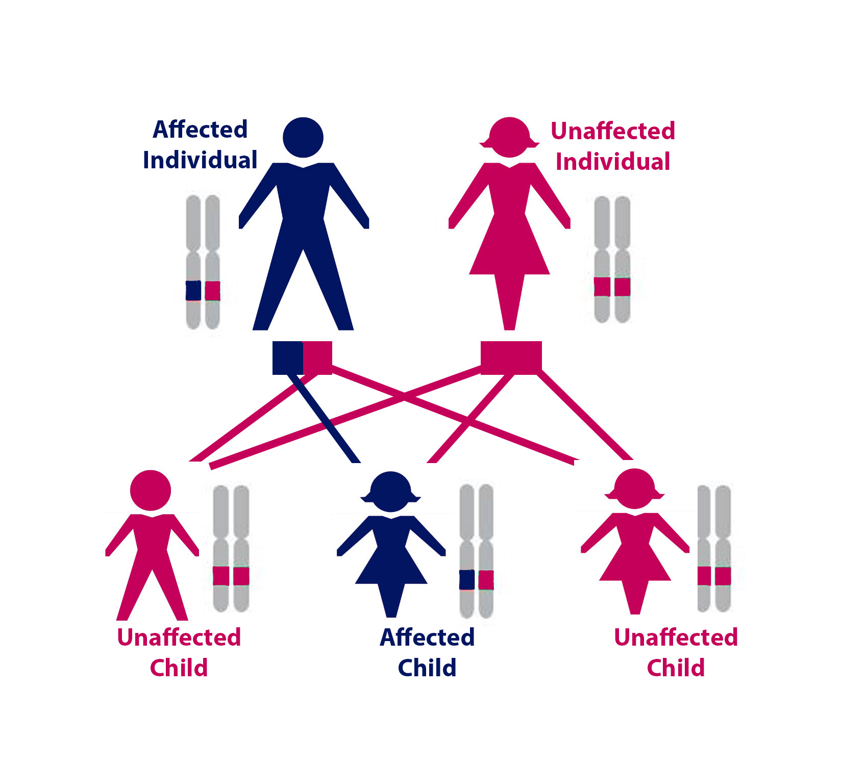 One possible configuration of a family of five, where one parent has HHT. Each of the three children had a 50% chance of inheriting the HHT gene mutation. In this case, only one of the three children inherited HHT.