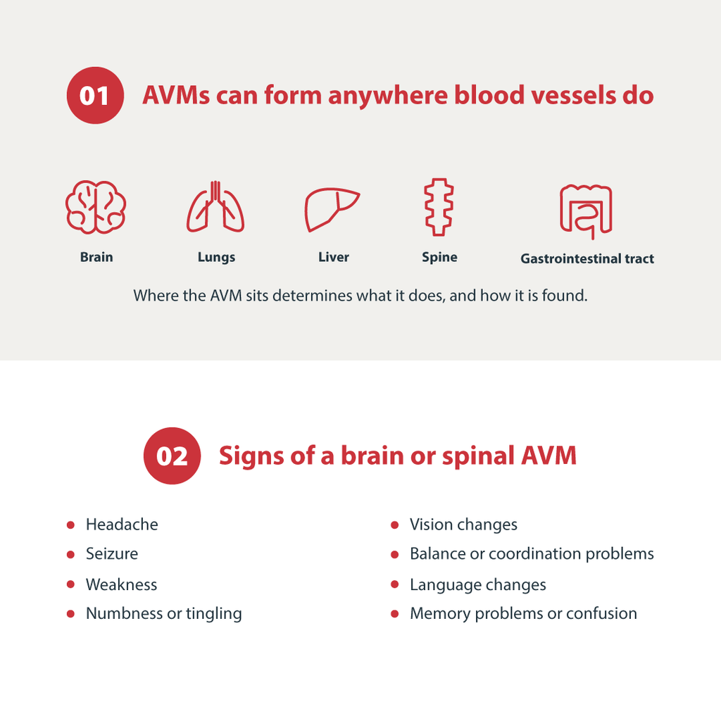 AVMs can form anywhere blood vessels do
Brain Lungs Liver Spine Gastrointestinal tract
Where the AVM sits determines what it does, and how it is found.

Signs of a brain or spinal AVM
Headache
Seizure
Weakness
Numbness or tingling
Vision changes
Balance or coordination problems
Language changes
Memory problems or confusion