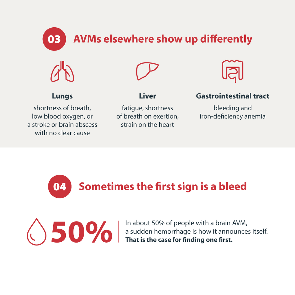 AVMs elsewhere show up differently
Liver
fatigue, shortness of breath on exertion, strain on the heart
Gastrointestinal tract
bleeding and iron-defciency anemia
Lungs
shortness of breath, low blood oxygen, or a stroke or brain
abscess with no clear cause

 Sometimes the first sign is a bleed
50% In about 50% of people with a brain AVM,
a sudden hemorrhage is how it announces itself.
That is the case for nding one rst.