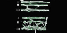 Angiogenesis Cover Vol. 22 No.4