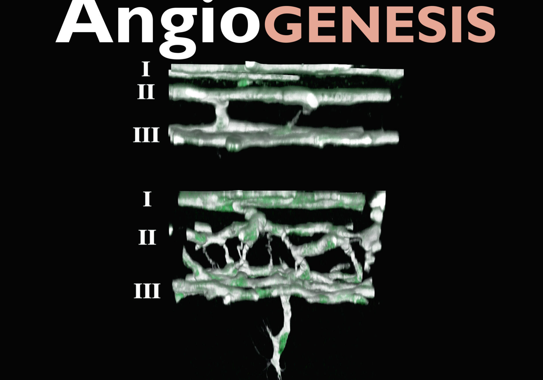 Angiogenesis Cover Vol. 22 No.4 Angiogenesis Cover Vol. 22 No.4