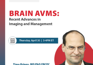 Webinar26_BrainAVMs-square2 (1)