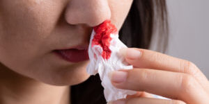 Girl Bloody Nose Tissue
